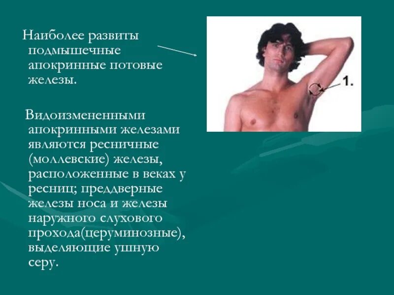Удалить потовую железу