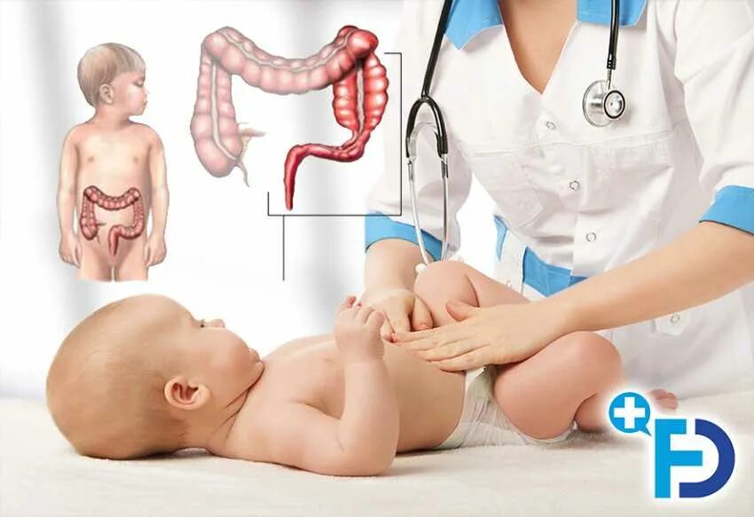 Проблемы с кишечником у ребенка. Для кишечника для новорожденных. Запоры у детей.