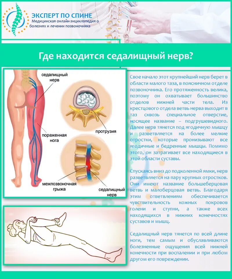 Сильные боли седалищных. Седалищный нерв. Седалищный нерв препараты уколы. Кеторол седалищный нерв. Сидящий нерв как лечить.