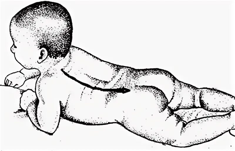 Рефлекс галанта у новорожденных. Установочные рефлексы новорожденных. Рефлекс ландау у новорожденных. Рефлекс галанта у новорожденных. Спинальный рефлекс галанта.