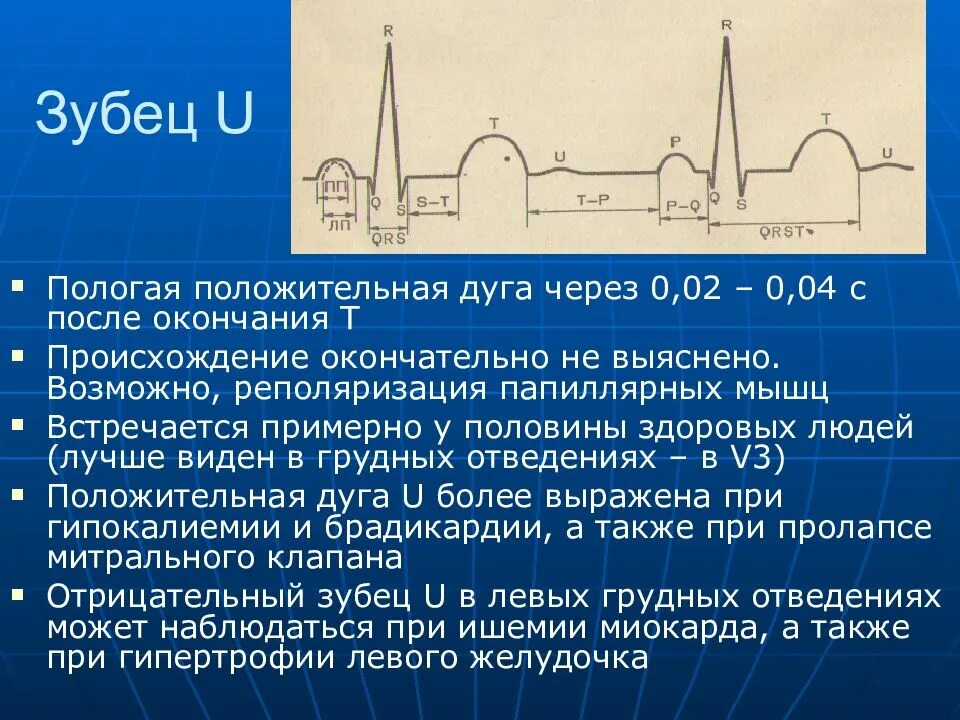 Патологический qrs. Патологический qrs