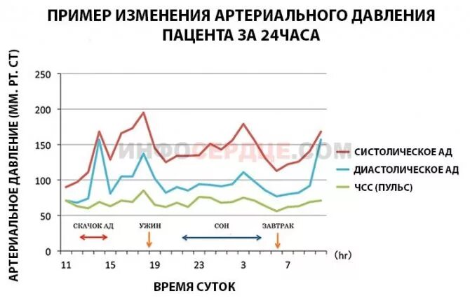 График давления человека в течении суток. График изменения артериального давления в течение суток. Суточный мониторинг артериального давления график. Норма колебания артериального давления. График пульса в течении суток у здорового человека.