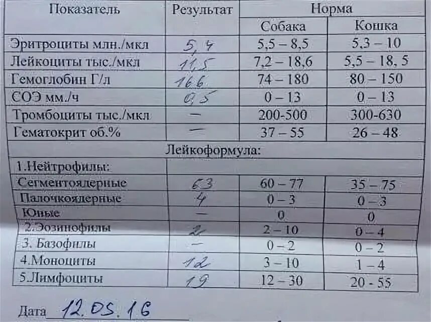 Соэ в моче у женщин. Анализ крови при анемии показатели. Соэ. Показатели соэ в крови норма у женщин. Соэ в моче у женщин.