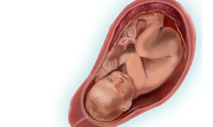 плод 37 недель беременности в животе. малыш на 36 неделе беременности в утробе. живот на 37 неделе беременности. ребенок в животе 37 недель. 38-40 недель беременности плод.