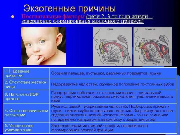 Экзогенные причины. Экзогенные причины развития ребенка. Экзогенные пороки развития. Экзогенные факторы нарушений развития.