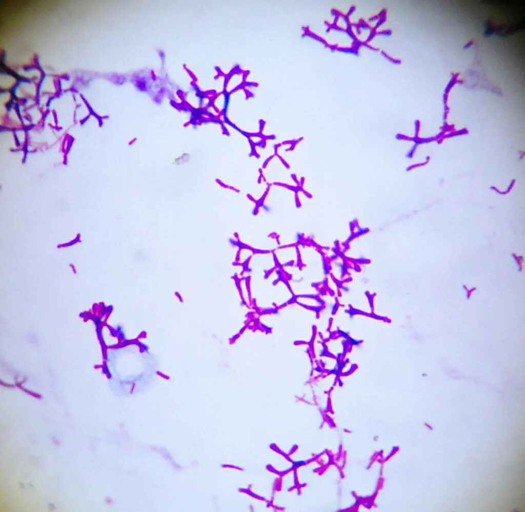 Палочка бифидобактерии. Микроскопия бифидобактерии бифидум. Bifidobacterium bifidum морфология. Bifidobacterium bifidum окраска по Граму. Bifidobacterium окраска по Граму.