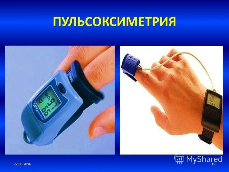 Пульсоксиметрия это. Пульсоксиметрия сатурация норма. пульсоксиметрия методика. проведение пульсоксиметрия. пульсоксиметр алгоритм измерения.