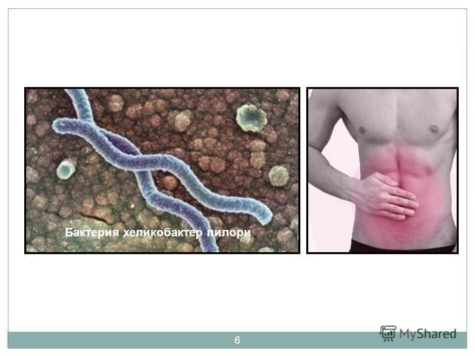 Пути передачи хеликобактер. Helicobacter pylori в 12-перстной кишке. хеликобактер пилори это глисты. паразиты в желудке хеликобактер. хилакобактерия пилори симптомы.