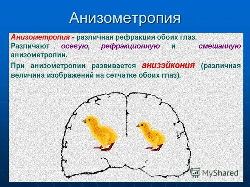 Анизометропия это в офтальмологии. Гиперметропическая анизометропия. Осевая анизометропия. Анизометропия и анизейкония.