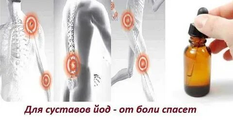 Йод для суставов