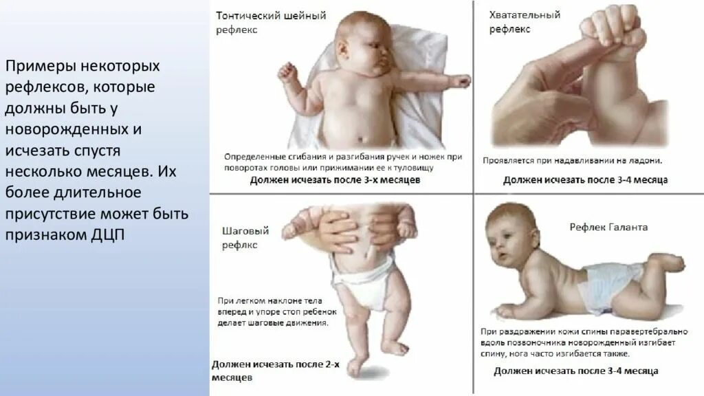 Почему пропадают рефлексы. Ранние проявления ДЦП У детей до года. Как определить ДЦП У грудничка 2 месяца. Ранние признаки ДЦП У грудного ребенка до 3 месяцев. Первые симптомы ДЦП У ребенка до года.