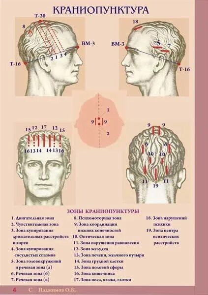 точки для массажа на ушных раковинах. скальпотерапия зоны. зоны краниопунктуры. зоны краниопунктуры. зоны краниопунктуры на голове.