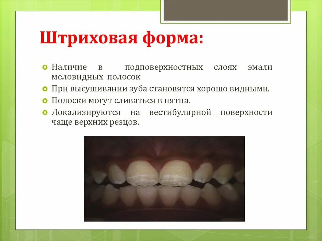 Классификация флюороза
