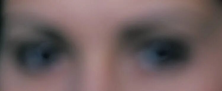 Туман зрение. Мелькание мушек перед глазами. Белая пелена перед глазами. Пелена перед глазами причины. Туман зрение.