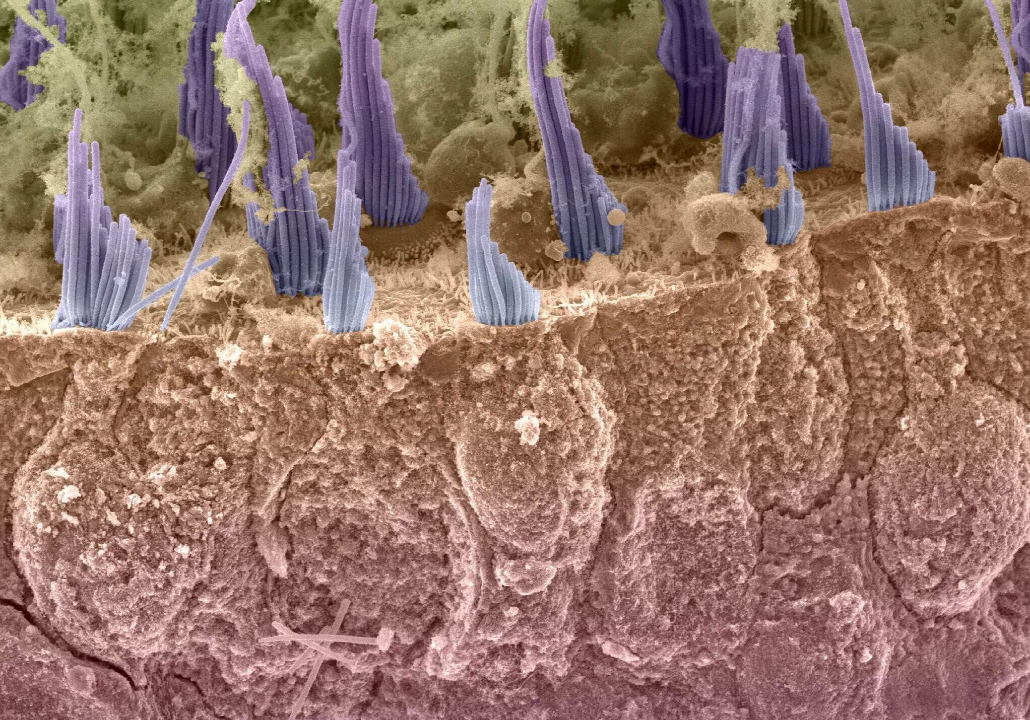 Волосковые клетки под микроскопом. Волосковые клетки снимок. Волосковые клетки в ухе. Клетки волос.