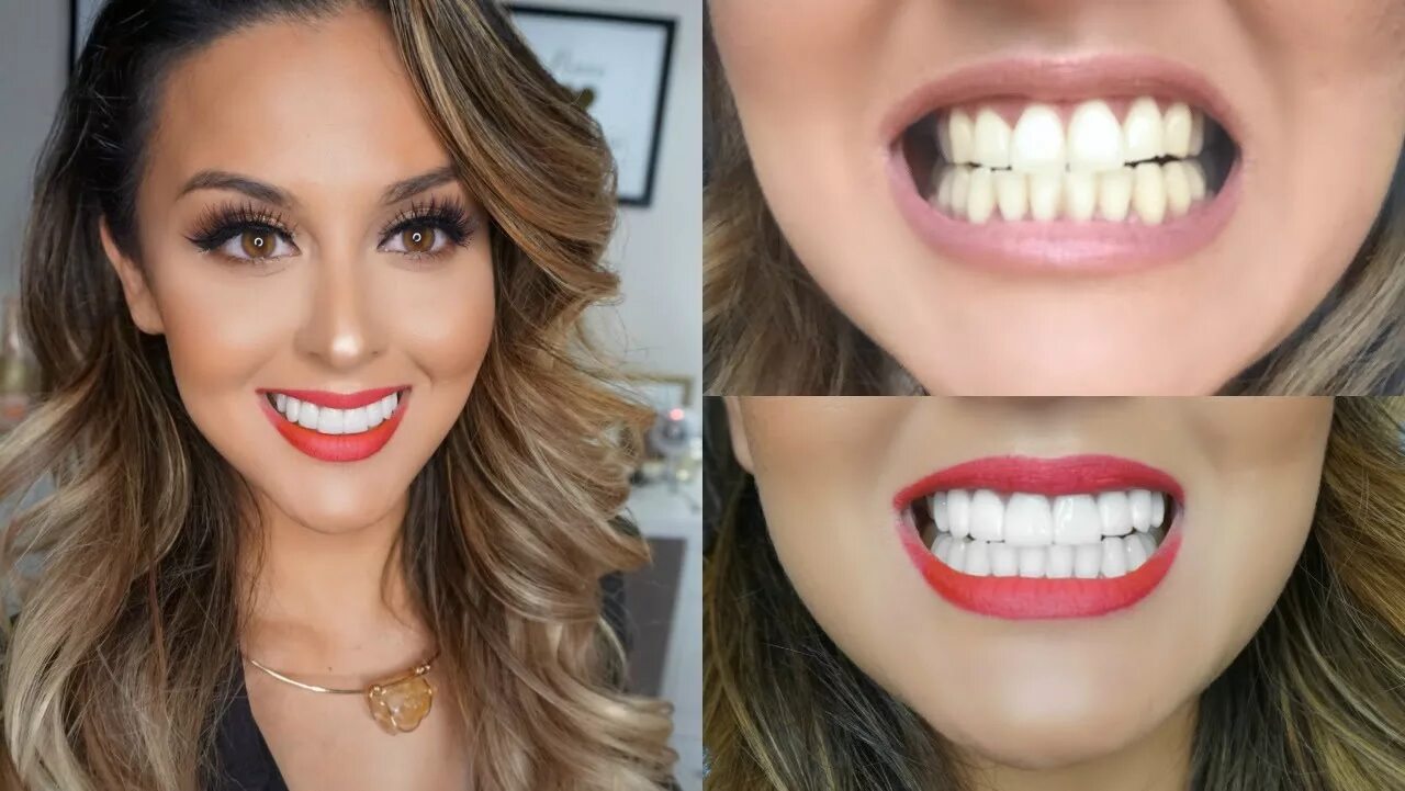Сколько по времени делают зубы. Красивые ровные зубы. Красивые зубы виниры. Красивая форма зубов. Голливудская улыбка.