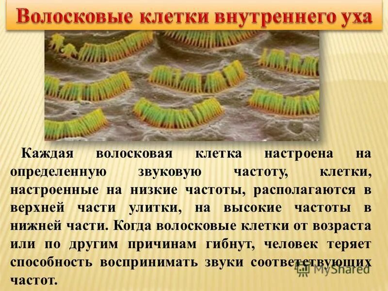 Клетки волосков улитки