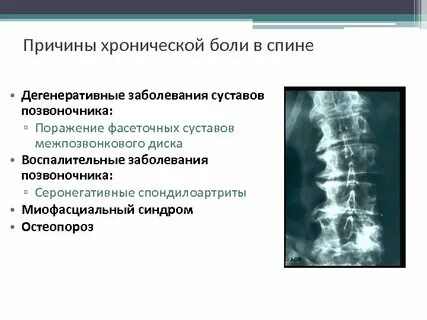 Дегенеративное изменение сустава это