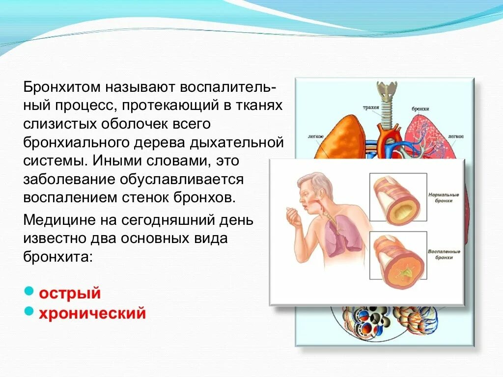 Бронхит заболеваемость. Бронхит это инфекционное заболевание. Заразен ли хронический бронхит. Острый бронхит это инфекционное заболевание.