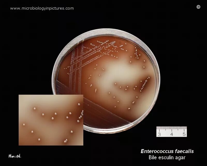 Enterococcus faecalis. Энтерококки faecalis. энтерококкус фациалис. энтерококки микробиология. агар энтерококк энтерококковый.