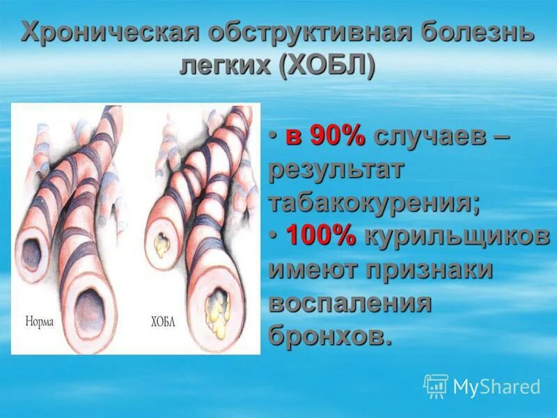 факты о вреде курения. последствия табакокурения. интересные факты о курении. 100 курильщиков. 100 курильщиков.