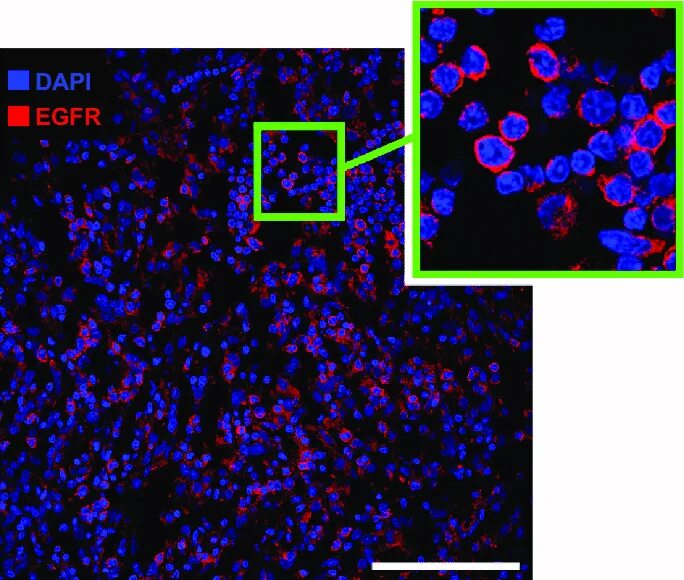 Эмиссионный спектр dapi. Апоптотические тельца dapi staining -. Hoechst 33258 окрашивание клетки. Dapi краситель. B.