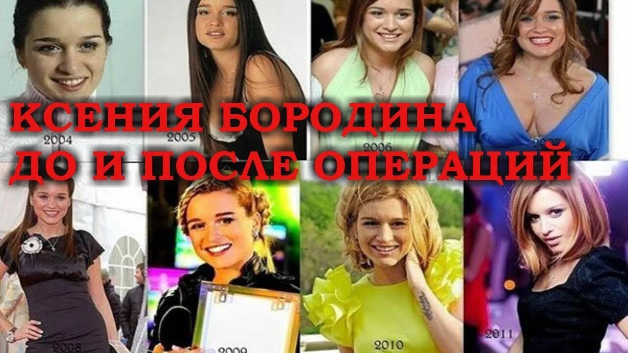 20 фото звезд, доказывающих, что их красота подарена вовсе не природой Lisa.ru