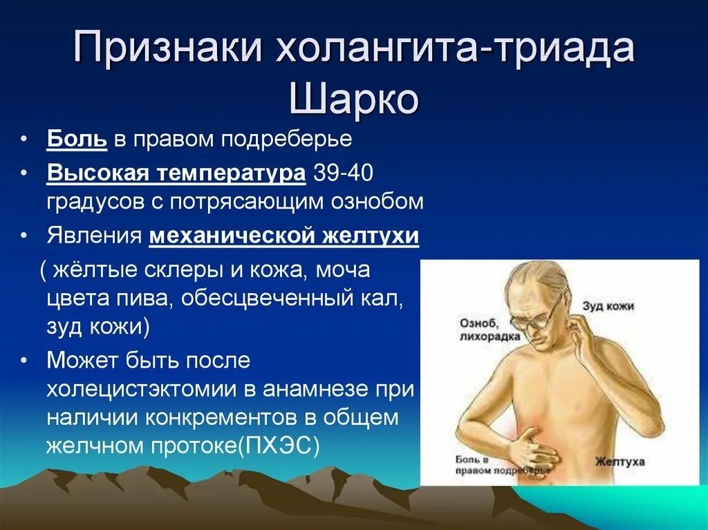 Лечение шарко. Клинические проявления холангита. Триада Шарко при холангите. Симптомов острого Гнойного холангита. Холангит симптомы.