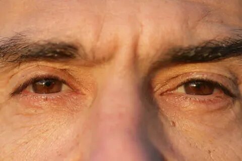 Narrow eyed