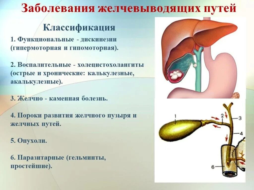 Холецистит причины заболевания. Болезни желчных путей классификация. Болезни желчного пузыря патология. Факторы желчнокаменной болезни. Классификация заболеваний желчного пузыря и желчных протоков.