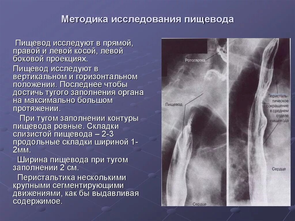 2 пищевод. Дисфункция пищевода рентген. Анатомические сужения пищевода рентген. Лучевое исследование пищевода. Рентгенологические методы исследования пищевода.