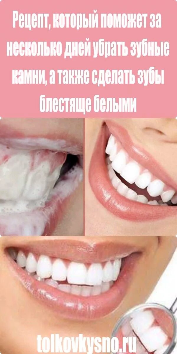 Что делать чтобы зубы были белыми. Белые зубы сделать. рецепт как сделать зубы белыми.