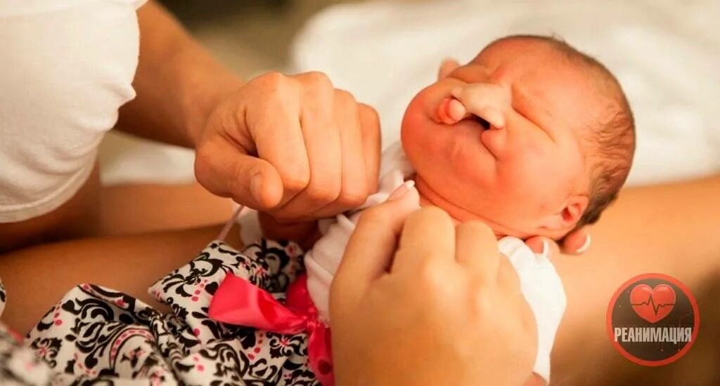 Расщелина неба у новорожденного фото 100 operated on for cleft lip SikhNet