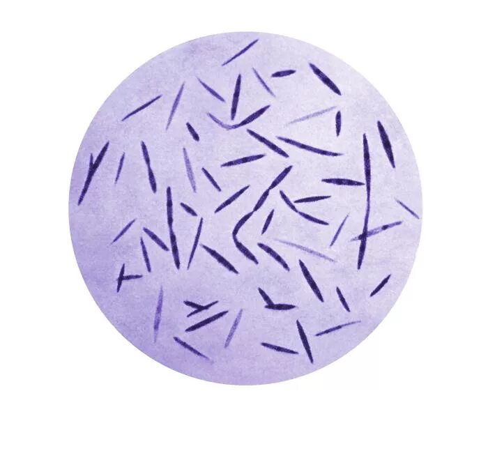 Fusobacterium spp