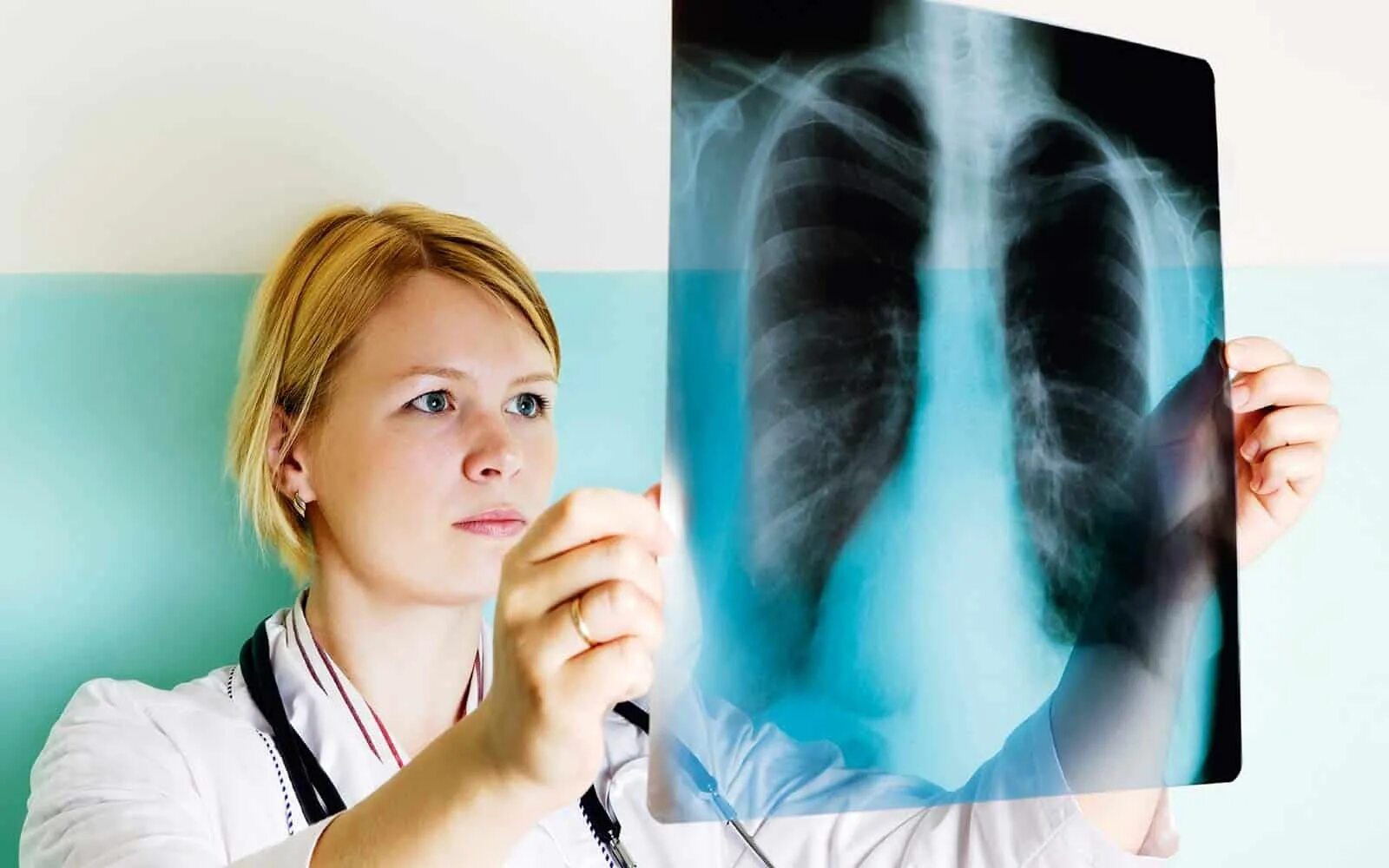 Лечение лимфоузла легкого. Пульмонология картинки. Заболевания органов дыхания человека. Фото саркоидоза легких.