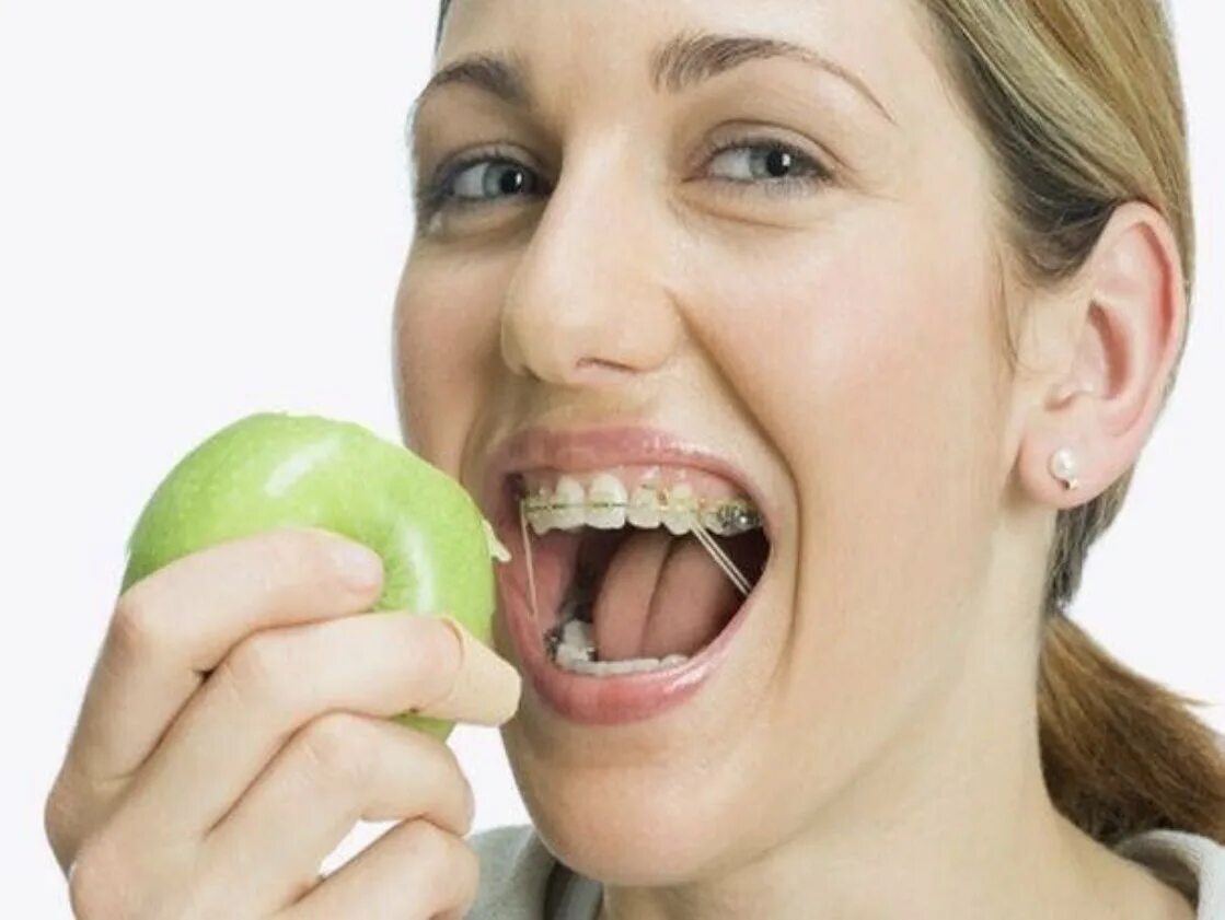 Можно ли есть зубы. Еда в зубах. Брекеты и яблоко.