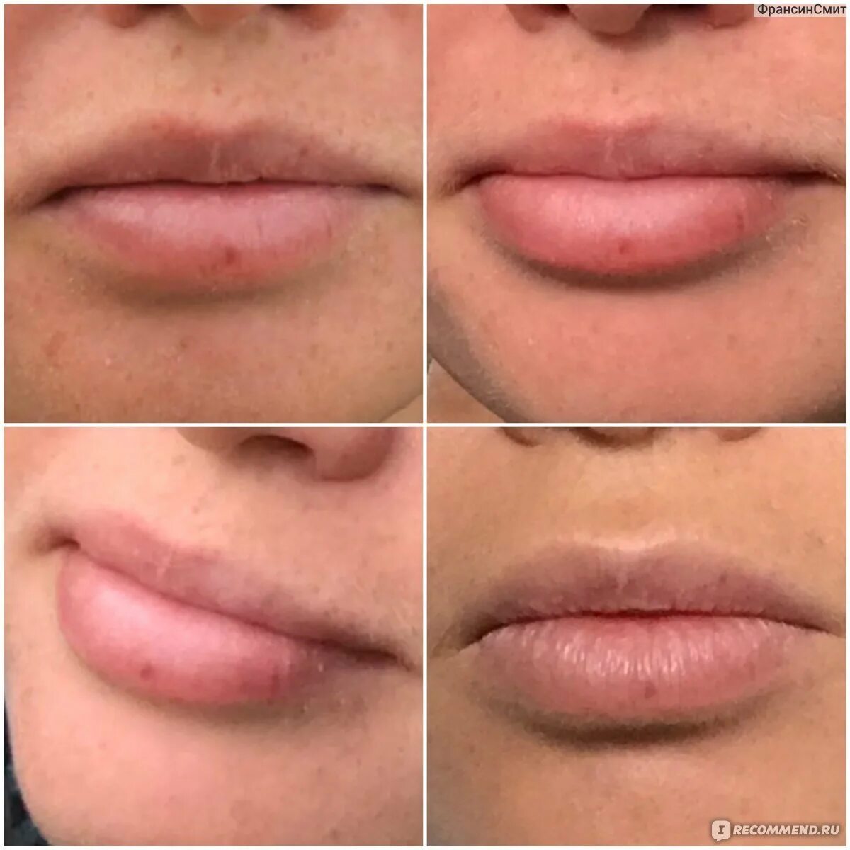 Губы до после и зажившие. Перманентный макияж губ до и после. Заживший перманентный макияж губ. Пудровые губы. Перманент губ до и после.