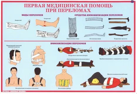 Скорая медицинская помощь при переломах