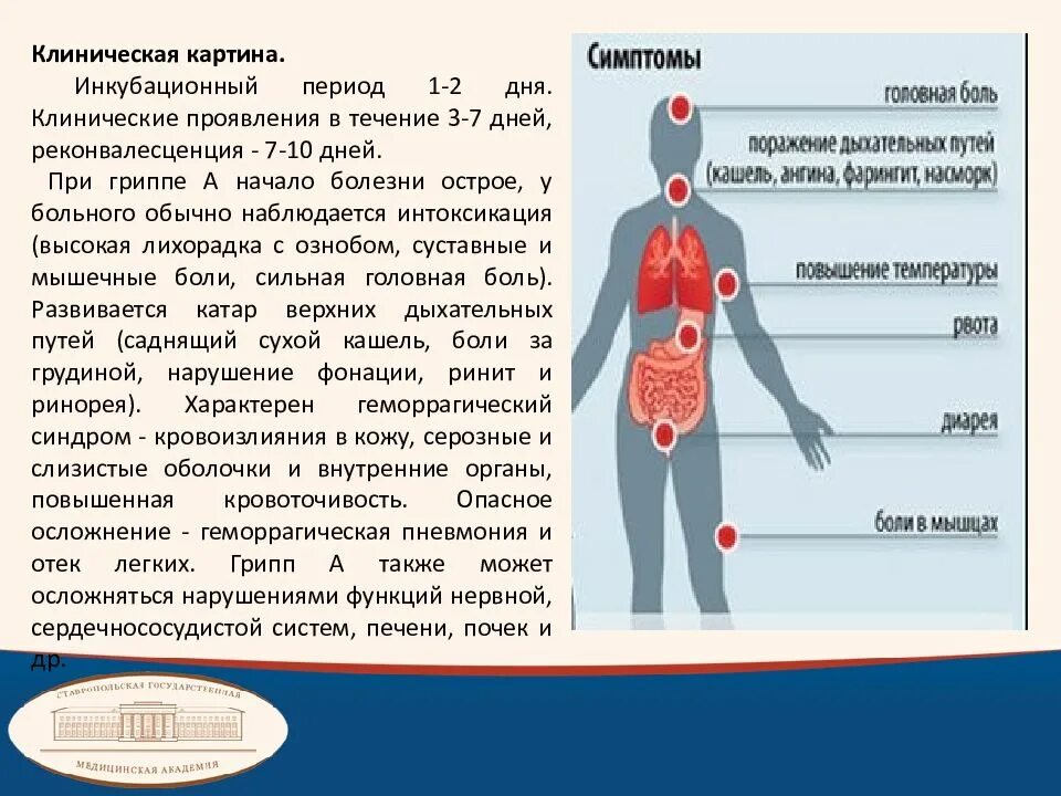 Заразен после гриппа. Инкубационный период гриппа. Клинические проявления гриппа. Клиническая картина гриппа. Грипп инкубационный период гриппа.