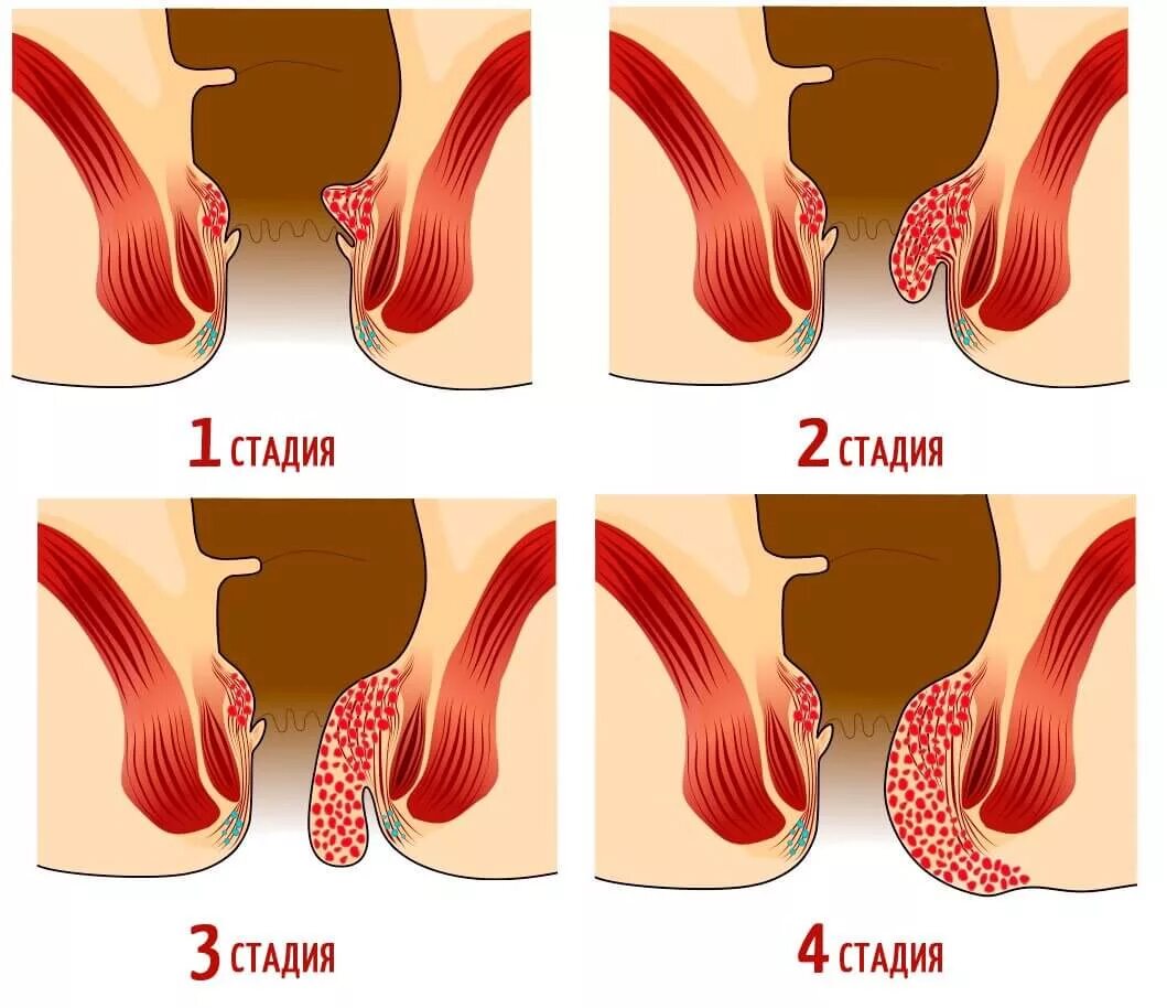 Лишайники это организмы. Белла хадид симметрия лица. Что такое выглядит. Доброкачественная выхухоль. Брюссельская капуста на грядке.