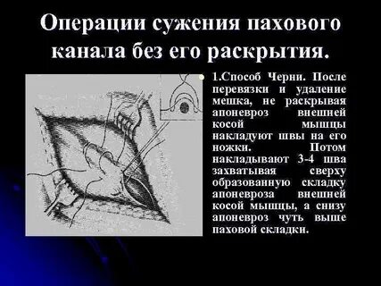 После операции стеноза
