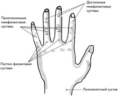 Межфаланговые суставы кисти