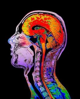 Brain side