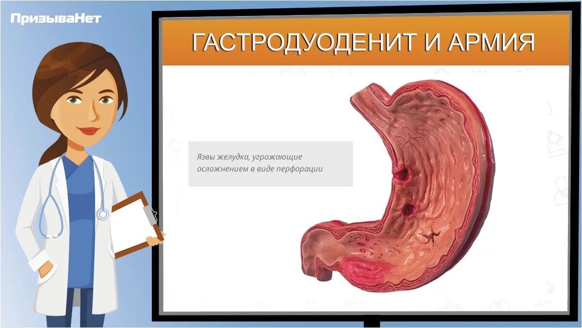 Может ли гастродуоденит. Хронический гастродуоденит. Хронический поверхностный гастродуоденит. Хронические поверхности гастродуоденит.