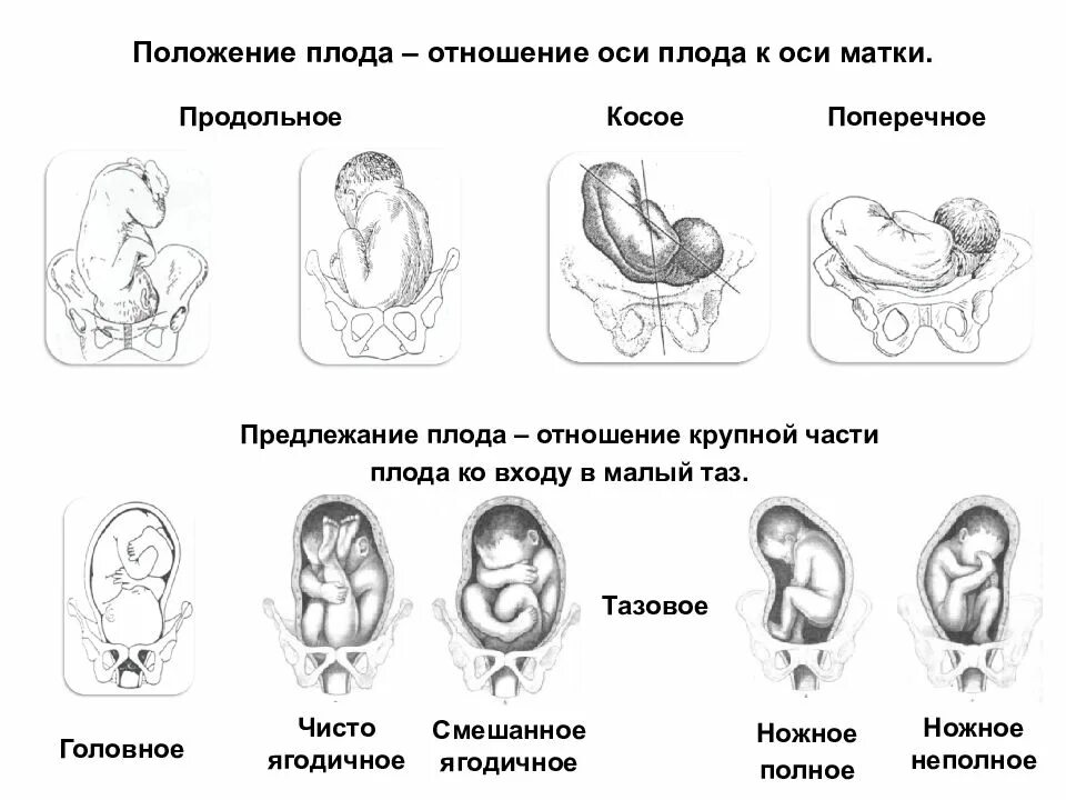 Как определить в каком положении находится. Головное предлежание косое положение плода. Положение плода продольное головное 1 позиция. Положение продольное тазовое 2 позиция. Продольное головное предлежание плода 32 недели беременности.