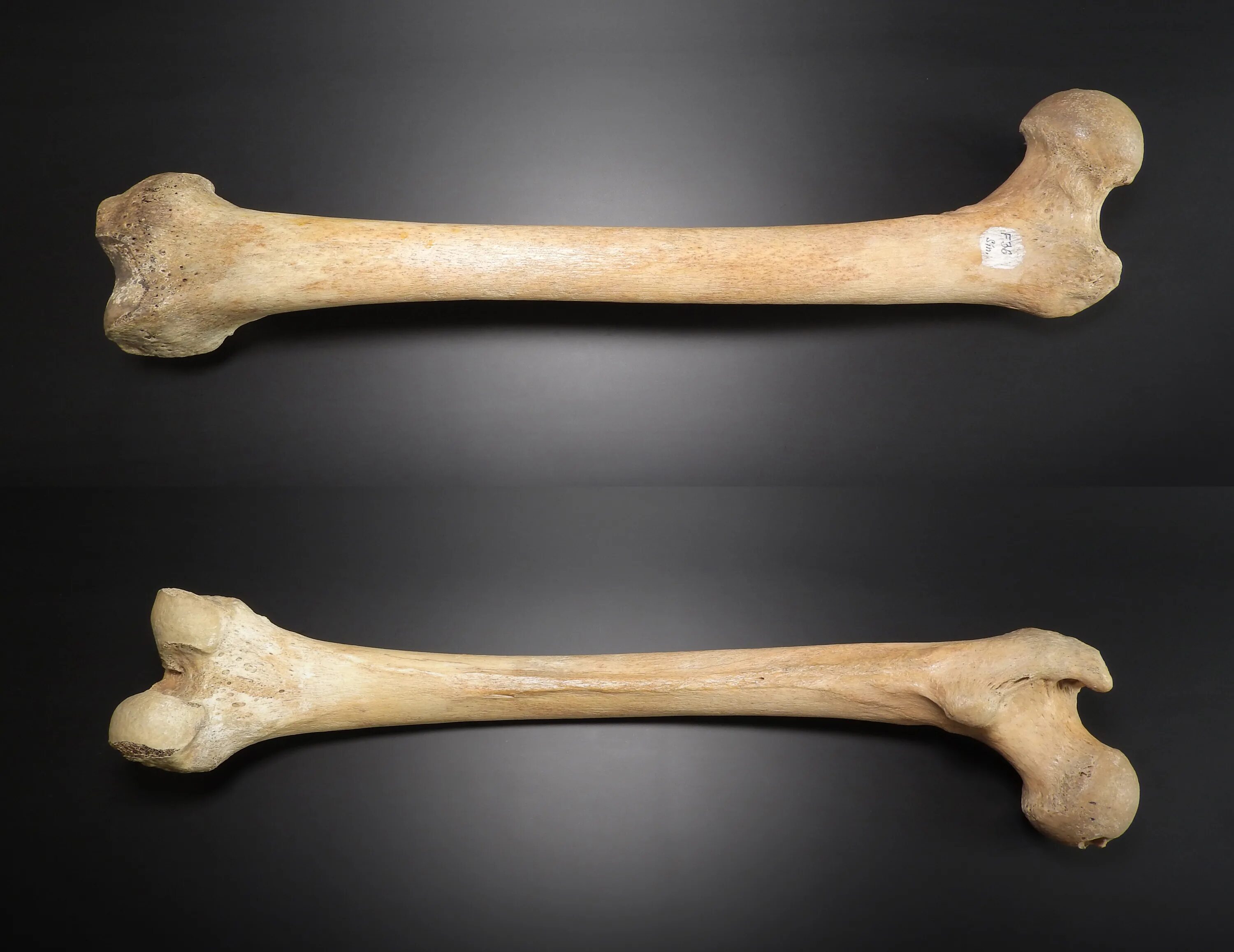 Образ кости. Бедренная кость (femur). Фемур. Femur diaphiz.