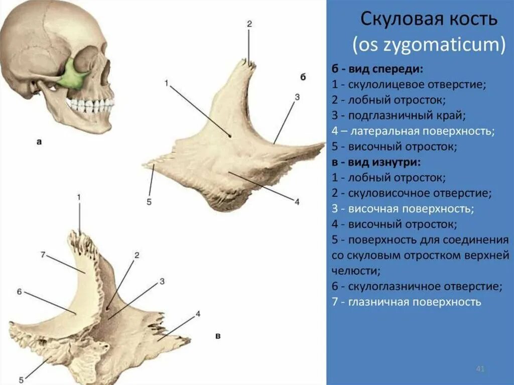 Перелом верхней скуловой кости. Верхняя челюсть анатомия скуловая кость. Скуловой отросток височной кости. Скуловая кость лицевого черепа. К какому отделу черепа относится скуловая кость