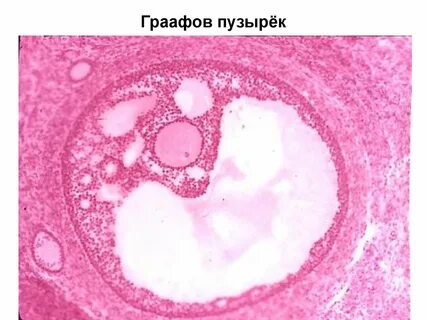 Фолликул 17 мм форум
