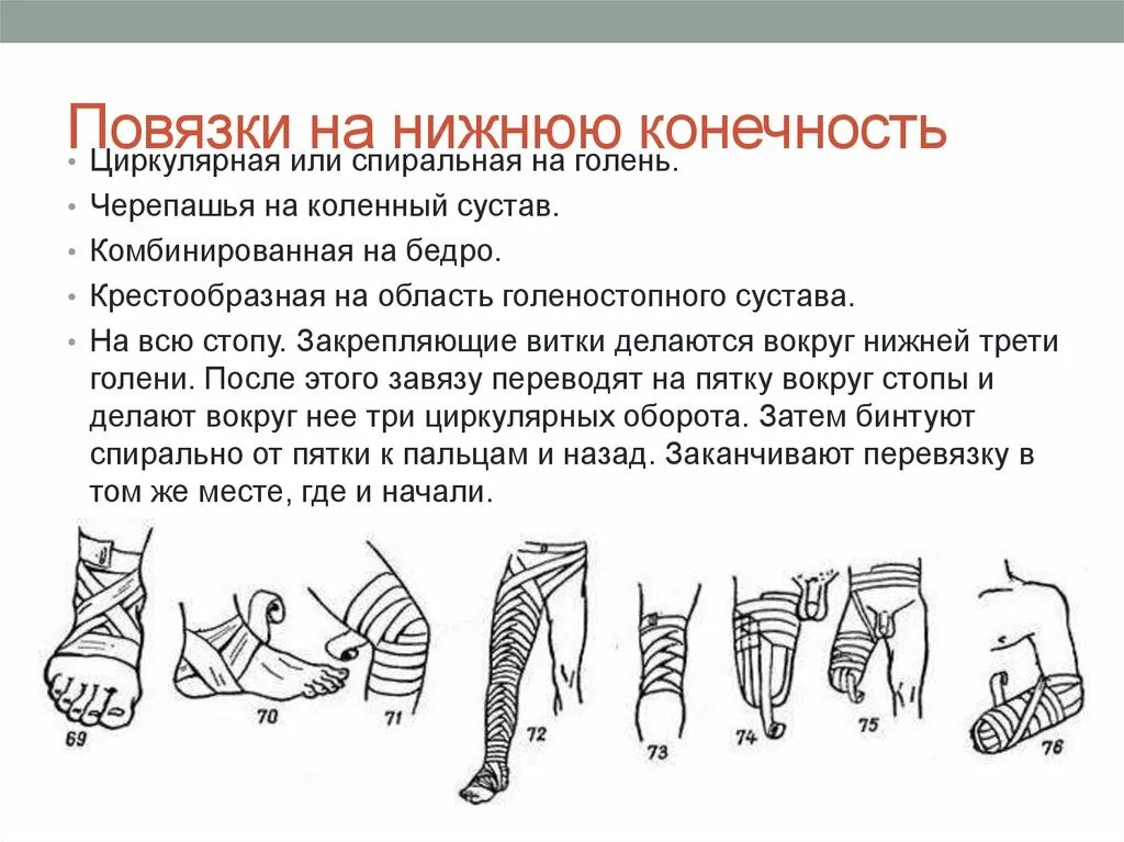 Способы наложения повязок при кровотечении. Техника наложения повязок на нижнюю конечность. Техника наложения повязок на Верхние конечности. Техника наложения бинтовой повязки на нижнюю конечность. Наложение повязок голова и Верхние конечности.