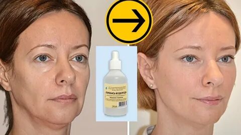 Перекись для отбеливания кожи
